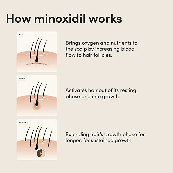 Minoxidil 5% Hair Growth Serum for Men – 6 Month Supply